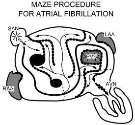 Maze Procedure